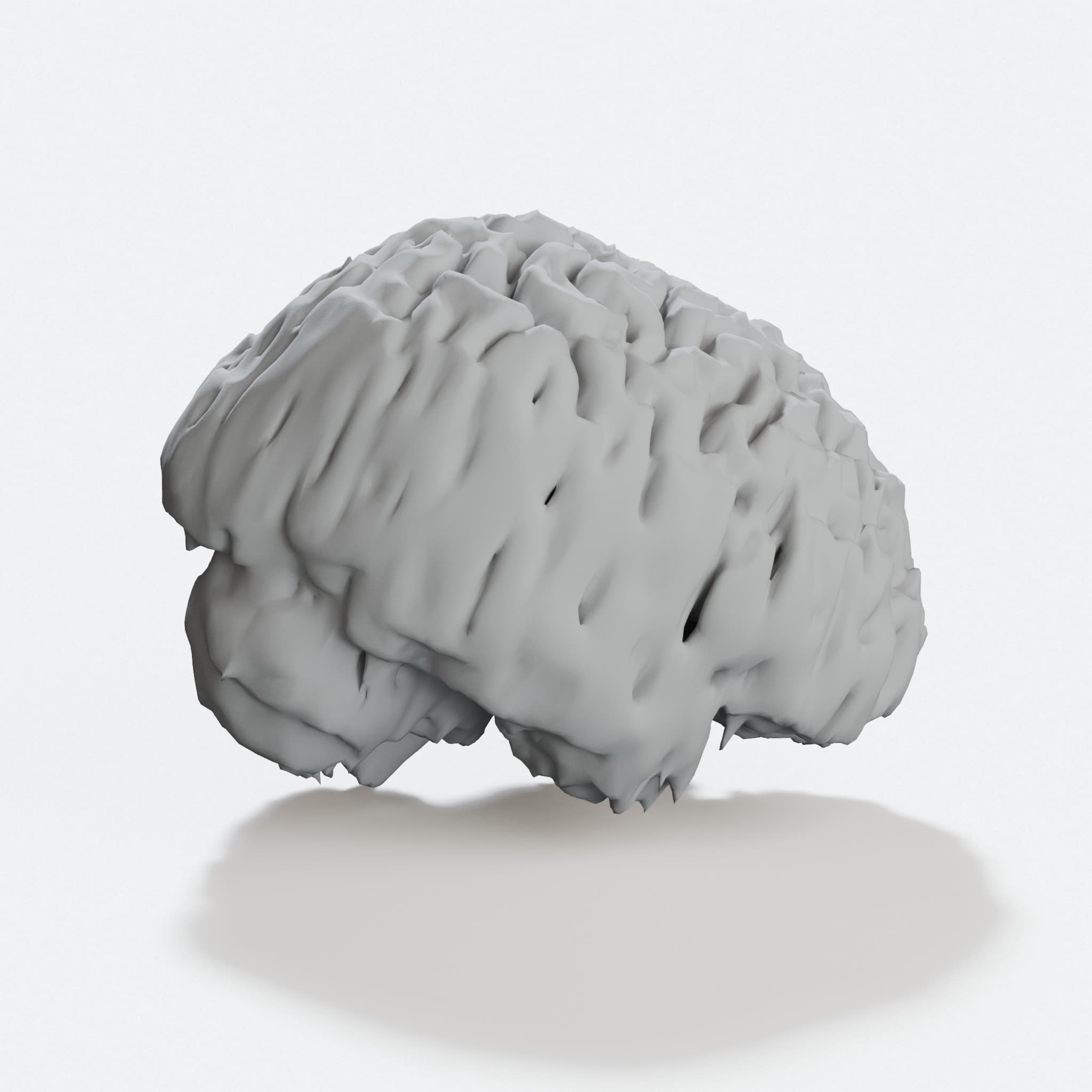I Think 3D-Printed Brain Model from MRI Data